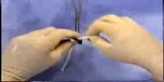 Ligation around a hemostatic Clamp Procedure