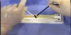 Surgical Tie Technique Squared Notch