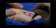 All suture techniques part 3