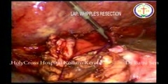 Minimal Access Surgery Video