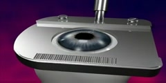 3D lasik eye surgery animation