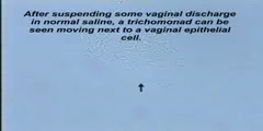 Preparing a Wet Mount of Vaginal Discharge