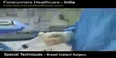 Breast Implantation in India