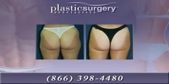 Lipo & Body Sculpting at San Francisco