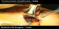 Buttock Lift Surgery