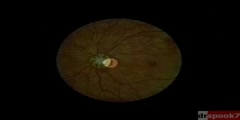 Eye Fundus Examination