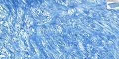 Histology Cartilage lab Fibrocartilage