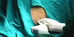 How a Lumbar Puncture is applied