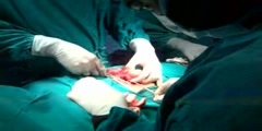 Performing a Nephrectomy