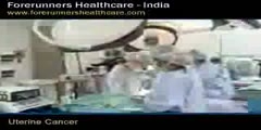 Uterine Cancer Treatment - India