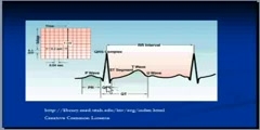 Signs And Symptoms of Pulmonary Embolism