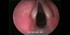 Video Stroboscopy of the Vocal Cords