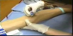 Structure of the Cannula and Cannulation