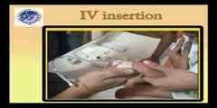IV insertion