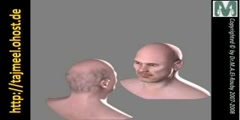 Hair Restoration Animation