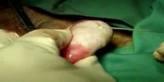 Testicular biopsy procedure