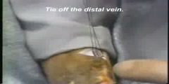 Techniques of venous access cut down