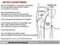 Selecting Site For IM Injection