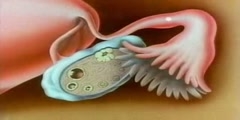 Conception