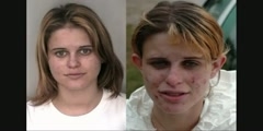 Crystal Meth Before and After