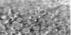 Zebrafish blastoderm exposed to ethanol