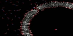 Vesicle Entry of Adenosine Mono-Phosphate