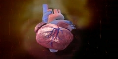 Medical animation heart stent MOA medical device