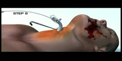 military medical 3d surgery medical education