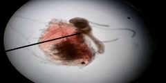 Hydra Eating Daphnia