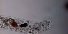 Large active amoeba