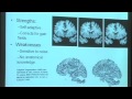 Lec 32 - Medical Imaging Computing: From Data to Understanding