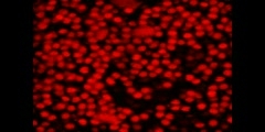 Colloid Particles under Brownian Motion