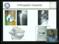 Lec - 19 ME C117  In Class Demonstrations: Knee, Hip,...