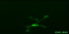 Neuronal symmetry breaking under microscope
