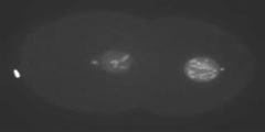 Centrosome size and function in nematode embryos