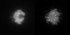 ElmoA and Actin in a Dictyostelium Amoeba