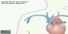 NurseReview.Org - Animation on Central Venous Line Insertion