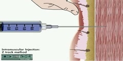 Animated demonstration of intramuscular injection