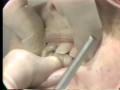 Lec 20 - Traumatic Occlusion: Orthodontic & Restorative Consideration