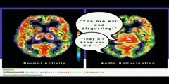 NurseReview.Org Animation on PET Scan