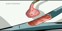 NurseReview.Org Animation on Reuptake Inhibitor