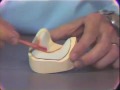 Lec 57 - Mandibular Wax Occlusal Rim