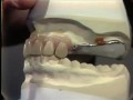 Lec 68-Setting Posterior Teeth for Immediate Maxillary Denture
