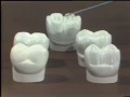 Lec 74- Types of Posterior Artificial Teeth