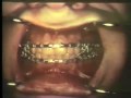 Lec 25 - Dental Anatomy and Oral Surgery