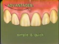 Lec 34 - Endodontic Surgery: Flap Design