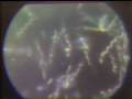 Lec 2 - Spirochetes through the microscope
