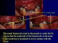 Lec 21 - DENT 718: Combination cases