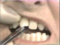 Lec 10 - Occlusion: Scleroderma and Occlusal Dysfunction