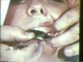 Lec21  - Occlusal Adjustment Part I  (Centric)